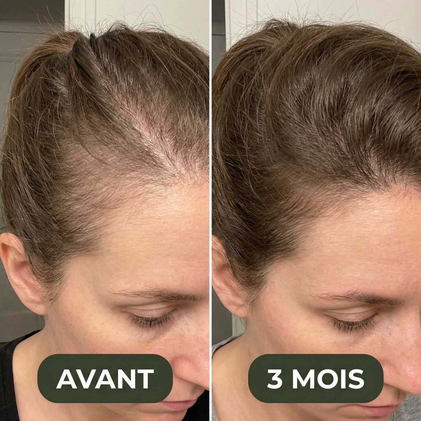 Avant après d'une femme Vitalis Cheveux