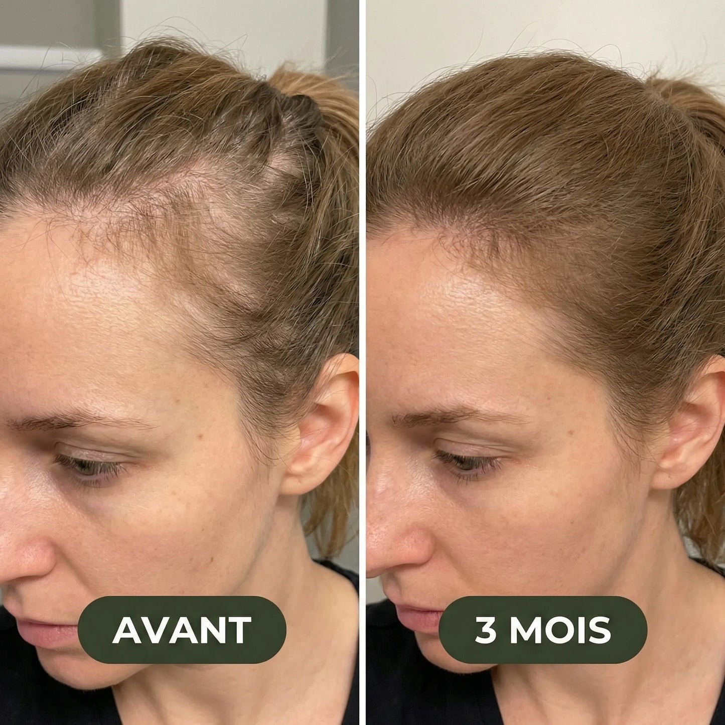 Sérum de croissance pour cheveux