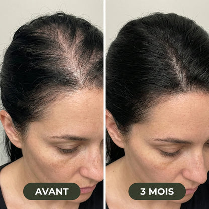 Sérum de croissance pour cheveux