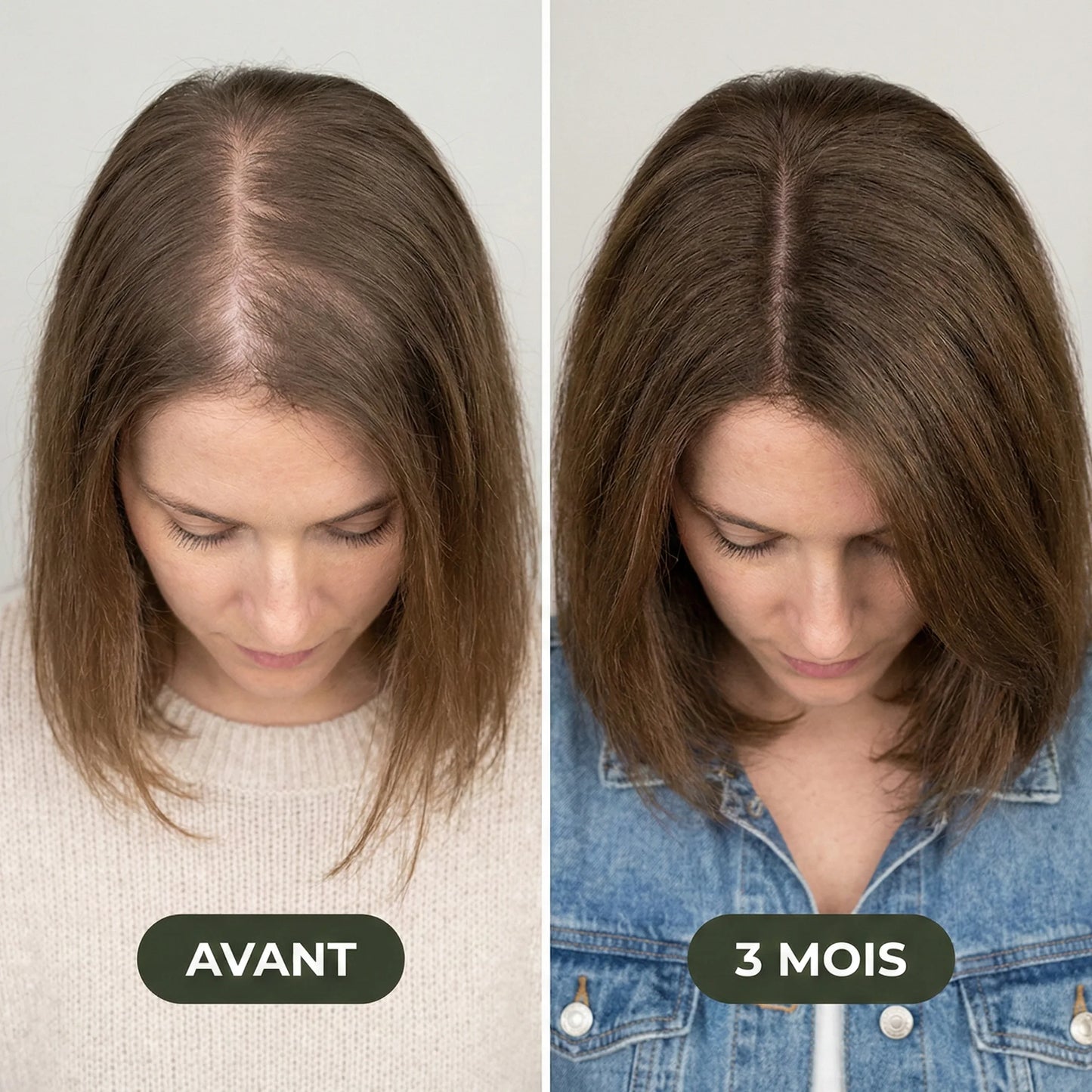 Sérum de croissance pour cheveux