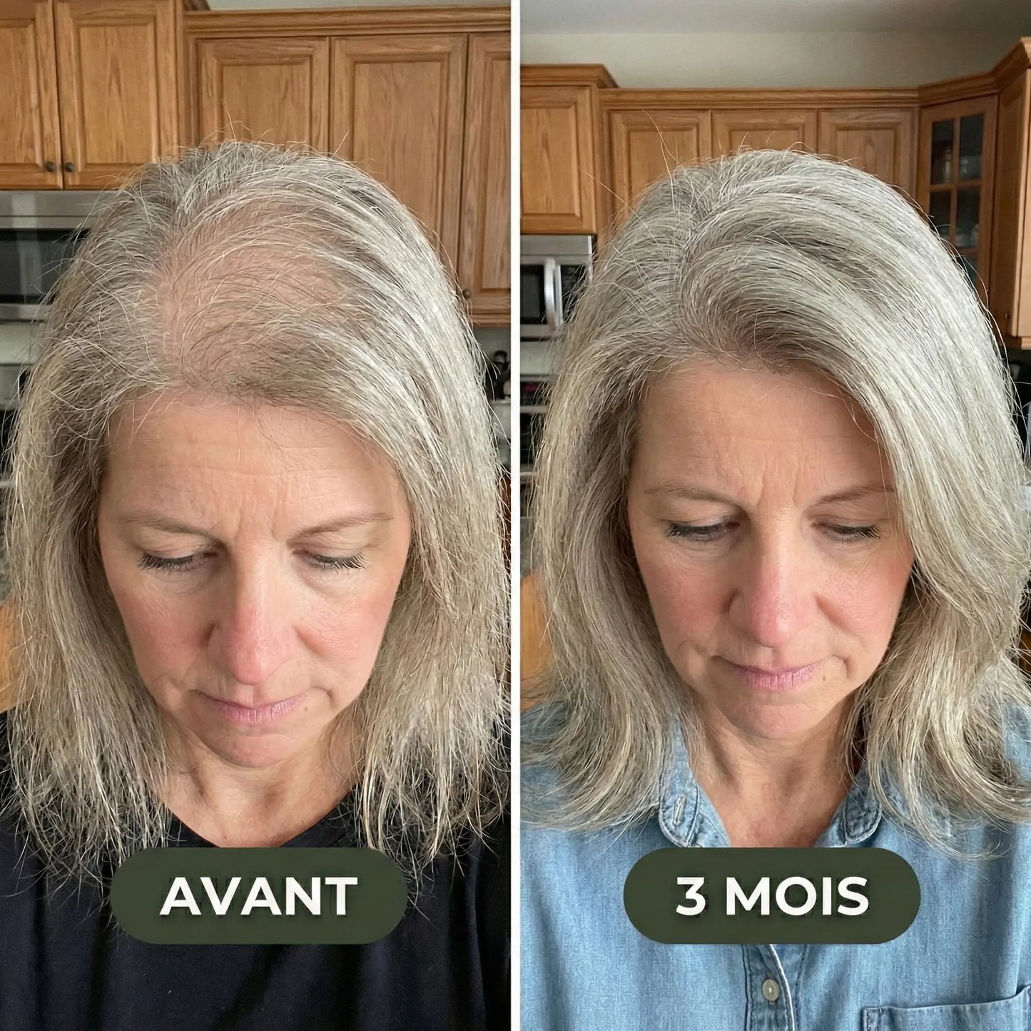 Sérum de croissance pour cheveux